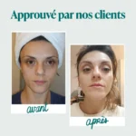 Collagène Marin en Poudre Type 1 & 3 – Image 4