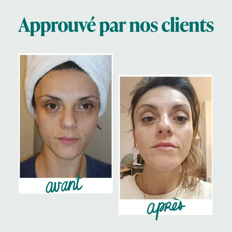 Photos avant et après d'une cliente, présentées comme témoignage d'utilisation du Collagène Marin